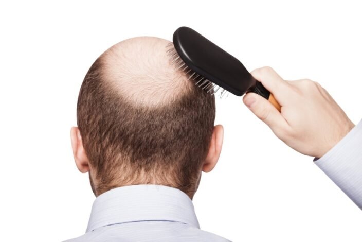 Mencegah dan Mengobati Kerontokan dengan Obat Penumbuh Rambut Kebotakan Rambut