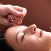 Acupuncture Treatment On Face
