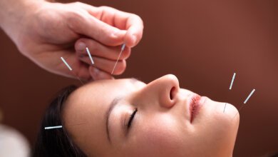 Acupuncture Treatment On Face