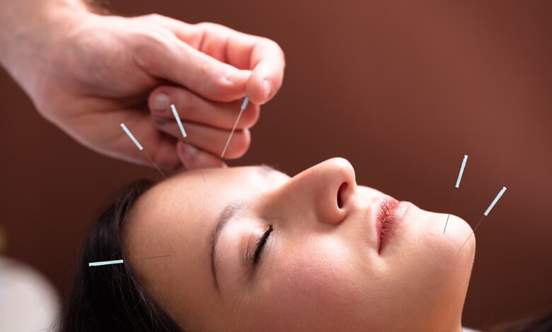 Acupuncture Treatment On Face