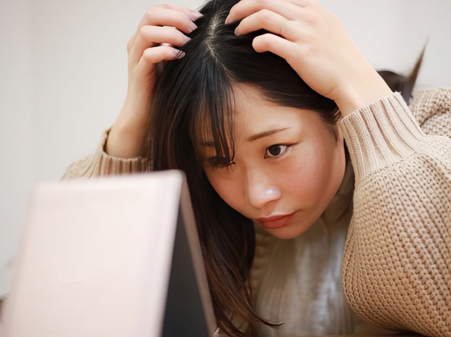 Jerawat Di Kulit Kepala