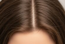 Perbedaan Kebotakan Pria & Wanita 3 cr