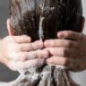 Young Woman Applying Anti Dandruff Product
