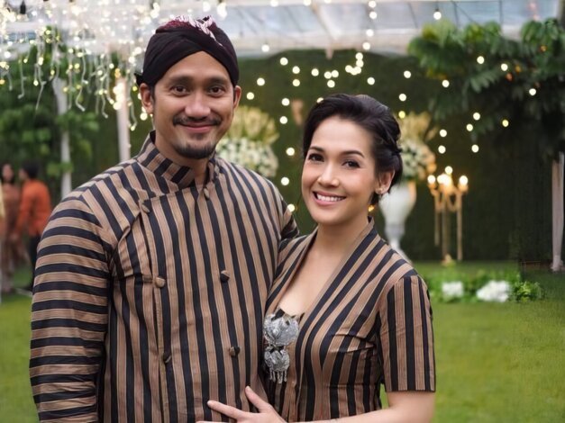 Merawat Kulit Menua dengan Teknologi Canggih untuk Tampil Awet Muda Salwasalon Com Tora Sudiro 2