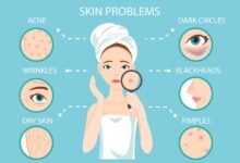 Salwasalon Com Skin Problems