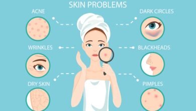 Salwasalon Com Skin Problems