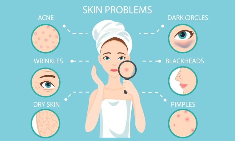 Salwasalon Com Skin Problems