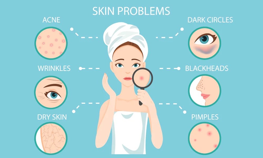 Mengatasi Masalah Kulit: Panduan Lengkap Solusi untuk Setiap Jenis ...