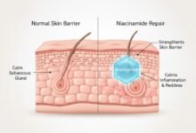Niacinamide untuk Kulit Berjerawat 1 cr