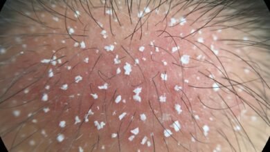 Review 5 Shampoo Anti Ketombe Paling Ampuh 1 cr