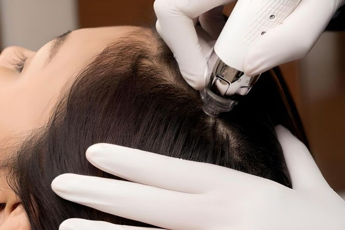 Tren Perawatan Kulit Kepala Untuk Kesehatan Rambut.jpg